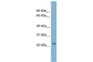 WB Suggested Anti-DUXA Antibody Titration:  0. (DUXA anticorps  (Middle Region))