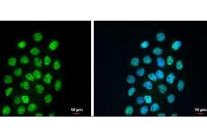 ICC/IF Image p63 antibody [N2C1], Internal detects p63 protein at nucleus by immunofluorescent analysis. (p63 anticorps)