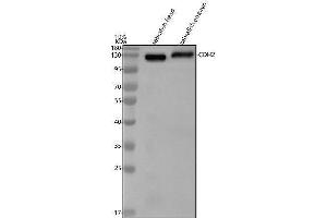 Western blot analysis of N-Cadherin/CDH2 using anti-N-Cadherin/CDH2 antibody (A).