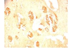 Rat brain tissue was stained by Rabbit Anti-Metasin (1-25) / KISS-1 (68-92) (Human) Serum