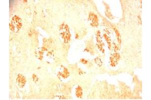 Rat brain tissue was stained by Rabbit Anti-Metasin (1-25) / KISS-1 (68-92) (Human) Serum (KISS1 anticorps  (AA 1-25, AA 68-92))