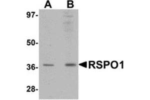Western Blotting (WB) image for anti-R-Spondin 1 (RSPO1) (N-Term) antibody (ABIN1031546)