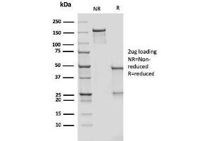 SDS-PAGE Analysis Purified CD209 Mouse Monoclonal Antibody (rC209/1781). (Recombinant DC-SIGN/CD209 anticorps)
