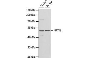 Western blot analysis of extracts of various cell lines, using NPTN antibody (ABIN6129584, ABIN6144789, ABIN6144790 and ABIN6223981) at 1:1000 dilution. (NPTN anticorps  (AA 29-200))