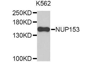 Western blot analysis of extracts of K-562 cells, using NUP153 antibody (ABIN5996414). (NUP153 anticorps)