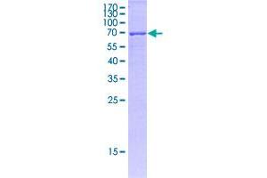 Image no. 1 for Major Histocompatibility Complex Class I C (HLA-C) (AA 1-366) protein (GST tag) (ABIN2752815)