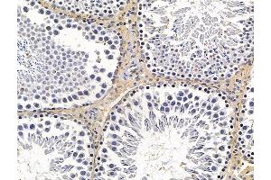 ABIN7096213 and ABIN7100275 at 1/100 staining rat testis tissue by IHC-P.