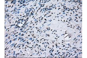 Immunohistochemical staining of paraffin-embedded colon tissue using anti-PSMA7mouse monoclonal antibody. (PSMA7 anticorps)