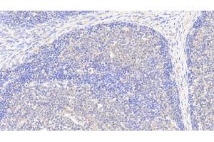 Detection of G6PD in Human Lymph node Tissue using Polyclonal Antibody to Glucose-6-phosphate Dehydrogenase (G6PD) (Glucose-6-Phosphate Dehydrogenase anticorps)