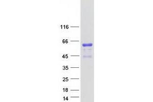 Validation with Western Blot