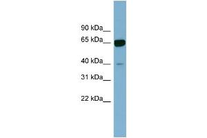 WB Suggested Anti-ZNF169 Antibody Titration:  0.