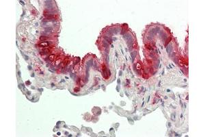 Human Lung, Repiratory Epithelium: Formalin-Fixed, Paraffin-Embedded (FFPE).
