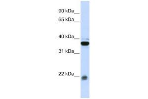 WB Suggested Anti-MYL9 Antibody Titration: 0. (MYL9 anticorps  (Middle Region))