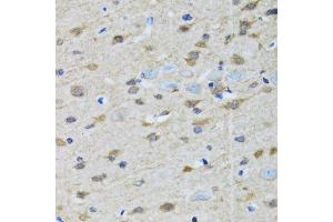 Immunohistochemistry of paraffin-embedded rat brain using GOLM1 antibody (ABIN5974385) at dilution of 1/100 (40x lens). (GOLM1 anticorps)