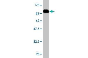 Western Blot detection against Immunogen (85. (ACD anticorps  (AA 1-544))