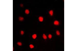 Immunofluorescent analysis of BRD3 staining in HepG2 cells.