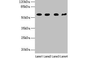 Western blot All lanes: KRT79 antibody at 1 μg/mL Lane 1: Mouse lung tissue Lane 2: A549 whole cell lysate Lane 3: 293T whole cell lysate Lane 4: Mouse gonadal tissue Secondary Goat polyclonal to rabbit IgG at 1/10000 dilution Predicted band size: 58 kDa Observed band size: 58 kDa (Cytokeratin 79 anticorps  (AA 1-300))