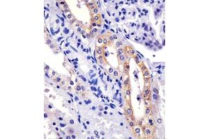 (ABIN6243380 and ABIN6577115) staining XI in human kidney sections by Immunohistochemistry (IHC-P - paraformaldehyde-fixed, paraffin-embedded sections). (XIAP anticorps)