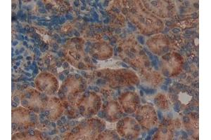 Detection of LIFR in Rat Kidney Tissue using Polyclonal Antibody to Leukemia Inhibitory Factor Receptor (LIFR)