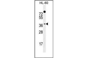 Western blot analysis of DUX4 / DUX10  Antibody  in HL-60 cell line lysates (35ug/lane). (DUX4 anticorps  (Middle Region))