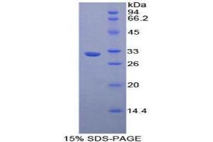 SDS-PAGE analysis of Human Nucleoporin 88 kDa Protein.
