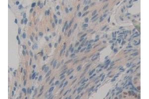 Detection of TICAM1 in Mouse Ovary Tissue using Polyclonal Antibody to Toll Like Receptor Adaptor Molecule 1 (TICAM1)