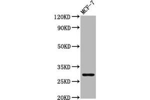 Western Blot Positive WB detected in: MCF-7 whole cell lysate All lanes: MYOZ2 antibody at 4. (MYOZ2 anticorps  (AA 90-180))