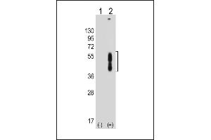 All lanes : Anti-PDCD1LG2 Antibody (N-term) at 1:8000 dilution Lane 1: Non-transfected 293T whole cell lysate Lane 2: Transfected PD-L2-transfected 293T whole cell lysate Lysates/proteins at 20 μg per lane. (PDCD1LG2 anticorps  (N-Term))