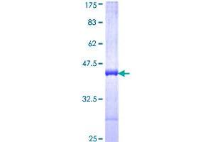 Image no. 1 for butyrobetaine (Gamma), 2-Oxoglutarate Dioxygenase (Gamma-butyrobetaine Hydroxylase) 1 (BBOX1) (AA 278-387) protein (GST tag) (ABIN1346462)