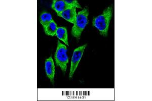 Confocal immunofluorescent analysis of LDHA Antibody with A375 cell followed by Alexa Fluor 488-conjugated goat anti-rabbit lgG (green). (Lactate Dehydrogenase A anticorps  (C-Term))