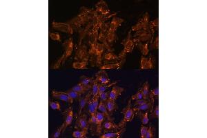 Immunofluorescence analysis of U-2 OS cells using HSD17B8 Polyclonal Antibody  at dilution of 1:100 (40x lens).