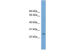 WB Suggested Anti-Dlx4 Antibody Titration: 0. (DLX4 anticorps  (Middle Region))