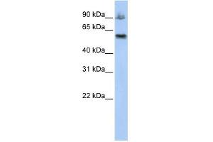 WB Suggested Anti-ASCC2 Antibody Titration:  0. (ASCC2 anticorps  (Middle Region))