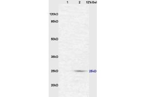 Lane 1: mouse intestine lysates Lane 2: mouse liver lysates probed with Anti CD161c/NK1. (NK-1.1/CD161c anticorps  (AA 101-200))