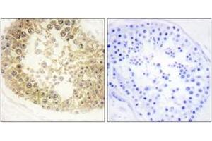 Immunohistochemistry analysis of paraffin-embedded human testis tissue, using ECRG4 Antibody. (C2orf40 anticorps  (AA 41-90))