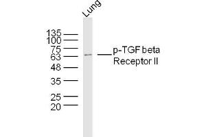 Mouse lung lysates probed with TGF beta Receptor II (Ser225) Polyclonal Antibody, Unconjugated  at 1:300 dilution and 4˚C overnight incubation.