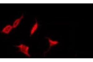 ABIN6278702 staining HepG2 by IF/ICC. (Varicella Zoster Virus Thymidine kinase (VZV TK) anticorps)