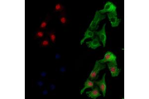 ABIN6257571 and ABIN6274504 staining Hela cells by IF/ICC. (ZNF541 anticorps  (Internal Region))