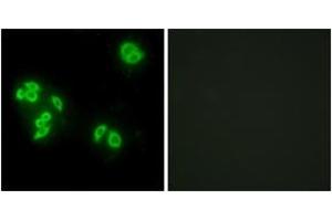 Immunofluorescence analysis of A549 cells, using TFIP8 Antibody. (Cytokeratin 5 anticorps  (AA 31-80))