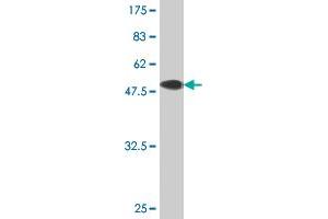 Western Blot detection against Immunogen (51. (TK1 anticorps  (AA 1-234))