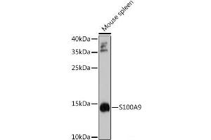 Western blot analysis of extracts of Mouse spleen using S100A9 Polyclonal Antibody at dilution of 1:1000. (S100A9 anticorps)