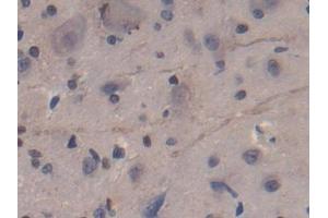 Used in DAB staining on fromalin fixed paraffin- embedded kidney tissue