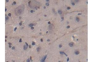 Used in DAB staining on fromalin fixed paraffin- embedded kidney tissue (CD8B anticorps  (AA 21-208))