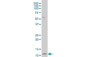 FXYD3 polyclonal antibody (A01), Lot # ISI4060209QCS1 Western Blot analysis of FXYD3 expression in A-431
