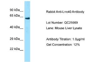 Host: Rabbit Target Name: Lrrc40 Sample Type: Mouse Liver Antibody Dilution: 1. (LRRC40 anticorps  (C-Term))