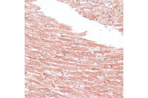 Immunohistochemistry of paraffin-embedded mouse heart using FZD4 antibody (ABIN6131550, ABIN6140841, ABIN6140842 and ABIN6224186) at dilution of 1:100 (40x lens). (FZD4 anticorps  (AA 37-222))