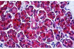 Human Pancreas: Formalin-Fixed, Paraffin-Embedded (FFPE) (PHGDH anticorps  (AA 1-534))