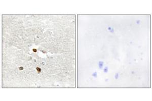 Immunohistochemistry analysis of paraffin-embedded human brain tissue using ZNF287 antibody. (ZNF287 anticorps  (Internal Region))