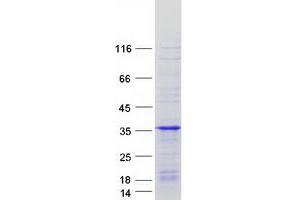 Validation with Western Blot