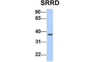 Host:  Rabbit  Target Name:  SRRD  Sample Type:  Jurkat  Antibody Dilution:  1. (SRRD anticorps  (Middle Region))